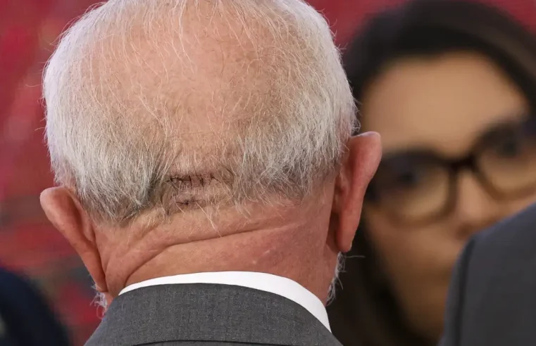 Lula faz exames em Brasília e apresenta quadro estável