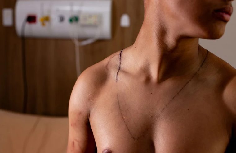 Jovem atingido por raio em ato de Nikolas recebe alta após três dias internado